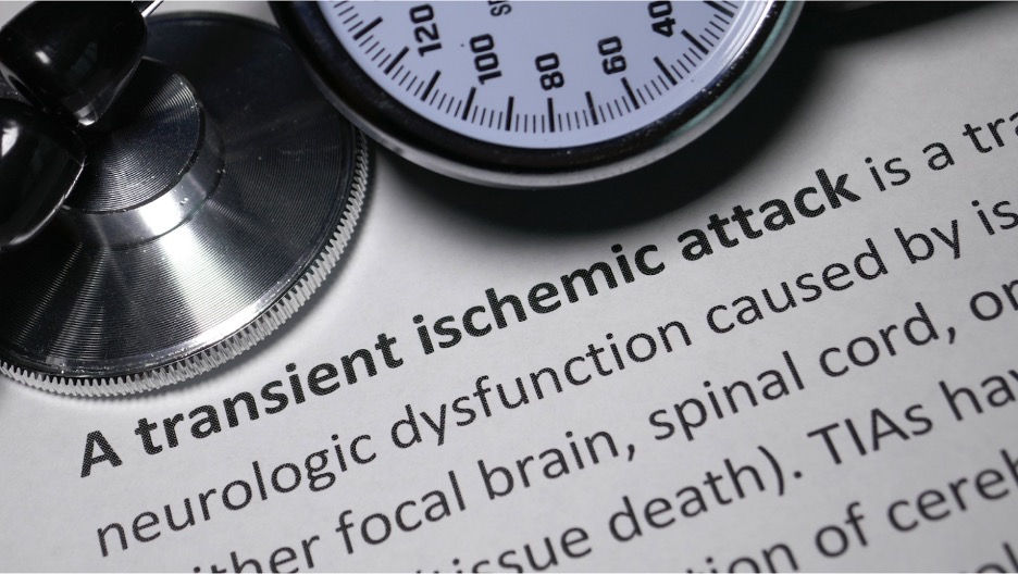 Approach to Managing Transient Ischemic Attack